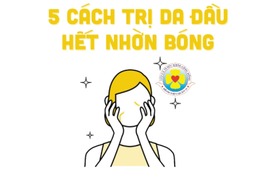 5 cách trị da dầu hết nhờn bóng